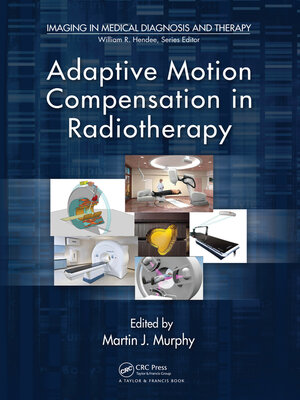 cover image of Adaptive Motion Compensation in Radiotherapy